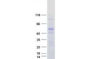 Validation with Western Blot (NR0B1 Protein (Myc-DYKDDDDK Tag))