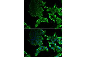 Immunofluorescence analysis of MCF-7 cells using SCYL1 antibody (ABIN5974072). (SCYL1 anticorps)