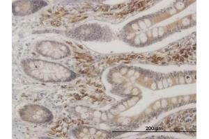 Immunoperoxidase of monoclonal antibody to MAPKAPK2 on formalin-fixed paraffin-embedded human small Intestine.