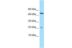 WB Suggested Anti-CGGBP1 Antibody Titration: 1. (CGGBP1 anticorps  (N-Term))
