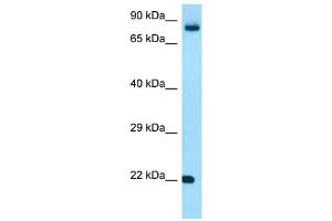 WB Suggested Anti-FGF18 Antibody Titration: 1. (FGF18 anticorps  (C-Term))