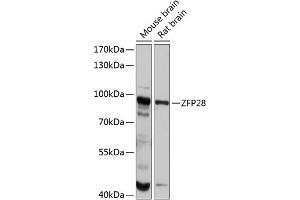 Western blot analysis of extracts of various cell lines, using ZFP28 antibody (ABIN6133031, ABIN6150430, ABIN6150431 and ABIN6215838) at 1:1000 dilution. (ZFP28 anticorps  (AA 1-349))
