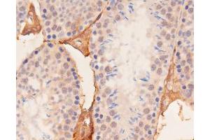 ABIN6267537 at 1/100 staining mouse kidney tissue sections by IHC-P. (YAP1 anticorps  (pSer127))