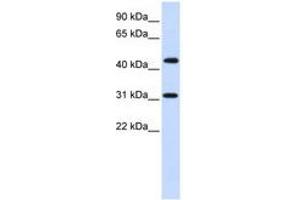 Image no. 1 for anti-Zinc Finger Protein 684 (ZNF684) (AA 72-121) antibody (ABIN6740403) (ZNF684 anticorps  (AA 72-121))