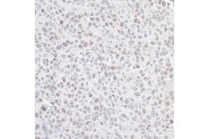Immunohistochemistry (IHC) image for anti-Guanine Nucleotide Binding Protein-Like 3 (Nucleolar) (GNL3) (C-Term) antibody (ABIN7453884) (Nucleostemin anticorps  (C-Term))