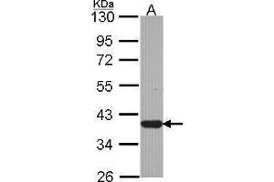 WB Image Sample (30 ug of whole cell lysate) A: JurKat 10% SDS PAGE antibody diluted at 1:1000 (LZTFL1 anticorps)