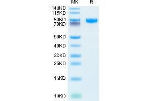 Human IL-18RAP on Tris-Bis PAGE under reduced condition. (IL18RAP Protein (AA 20-356) (Fc Tag))