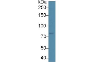 Detection of ADAMTS5 in Human Hela cell lysate using Polyclonal Antibody to A Disintegrin And Metalloproteinase With Thrombospondin 5 (ADAMTS5)