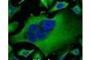 Immunofluorescence analysis of Hela tissue using beta Tubulin Monoclonal Antibody at dilution of 1:100.