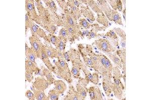 Immunohistochemistry of paraffin-embedded human liver injury using HSD17B13 Antibody. (HSD17B13 anticorps  (AA 20-300))