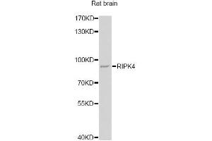 Western blot analysis of extracts of rat brain, using RIPK4 antibody (ABIN6292235) at 1:1000 dilution.