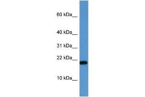 WB Suggested Anti-SH2D1A  Antibody Titration: 0. (SH2D1A anticorps  (C-Term))