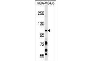 PIK3CB Antibody (N-term ) (ABIN652426 and ABIN2842105) western blot analysis in MDA-M cell line lysates (35 μg/lane).