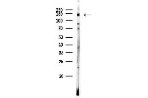 anti-Protein Phosphatase 1, Regulatory Subunit 3A (PPP1R3A) (Internal Region) antibody