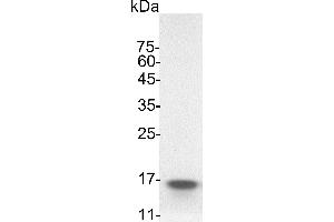Colony Stimulating Factor 2 (Granulocyte-Macrophage) (CSF2) (Active) protein (His tag)