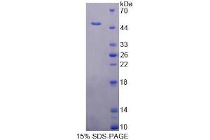 SDS-PAGE analysis of Human TNNC1 Protein. (TNNC1 Protéine)