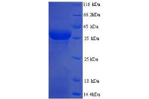 SDS-PAGE (SDS) image for Squamous Cell Carcinoma Antigen Recognized By T Cells 3 (SART3) (AA 600-900), (partial) protein (His tag) (ABIN5714352)
