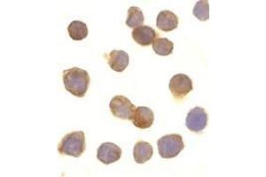 Immunocytochemistry of DR3 in Jurkat cells with AP30297PU-N DR3 antibody at 10 μg/ml.