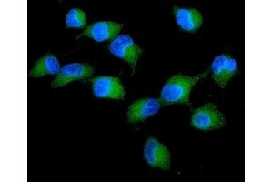 IF analysis of PRKCD using anti-PRKCD antibody (ABIN7601631).