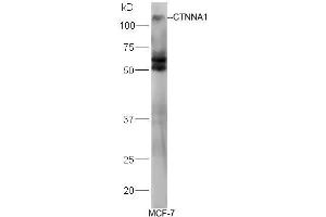 Human MCF-7 lysates probed with Rabbit Anti-Alpha Catenin/CTNNA1 Polyclonal Antibody, Unconjugated (ABIN731813) at 1:300 overnight at 4˚C. (CTNNA1 anticorps  (AA 801-906))