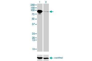 Western blot analysis of THNSL1 over-expressed 293 cell line, cotransfected with THNSL1 Validated Chimera RNAi (Lane 2) or non-transfected control (Lane 1). (THNSL1 anticorps  (AA 151-250))