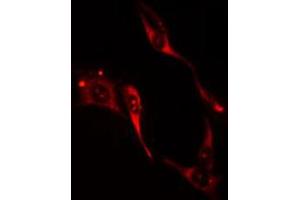 ABIN6274205 staining HuvEc cells by IF/ICC. (ITPKA anticorps  (N-Term))
