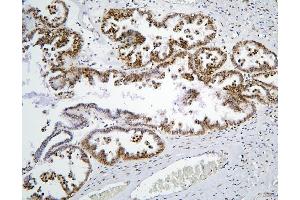 IHC analysis of PHF21A using anti-PHF21A antibody (ABIN6719353). (PHF21A anticorps  (AA 1-97))