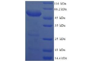 SDS-PAGE (SDS) image for Syndecan 1 (SDC1) (AA 23-257), (Extracellular) protein (GST tag) (ABIN5710322)