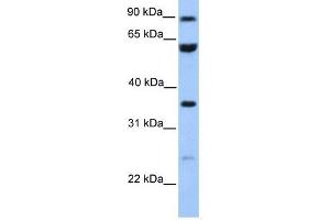 CCDC7 antibody used at 1 ug/ml to detect target protein. (CCDC7 anticorps  (N-Term))