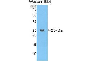 Western Blotting (WB) image for anti-Coagulation Factor IX (F9) (AA 61-263) antibody (ABIN1858770) (Coagulation Factor IX anticorps  (AA 61-263))