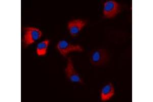 Immunofluorescent analysis of CaMK2 alpha/delta (pT286) staining in HeLa cells. (CaMK2 alpha/delta anticorps  (pSer286))