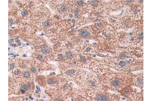 Detection of SOD2 in Human Liver Tissue using Polyclonal Antibody to Superoxide Dismutase 2, Mitochondrial (SOD2) (SOD2 anticorps  (AA 25-222))