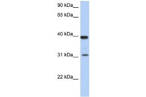 RPSA antibody used at 1 ug/ml to detect target protein. (RPSA/Laminin Receptor anticorps  (Middle Region))