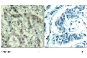 Image no. 1 for anti-Aurora Kinase A (AURKA) (pThr288) antibody (ABIN319282) (Aurora A anticorps  (pThr288))
