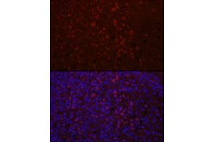 Immunofluorescence analysis of human spleen using CD4 Rabbit pAb (ABIN6134777, ABIN6138187, ABIN6138189 and ABIN6213821) at dilution of 1:100 (40x lens).