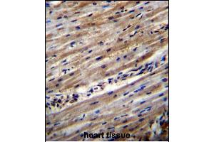 DUS1L Antibody (C-term) (ABIN656451 and ABIN2845736) immunohistochemistry analysis in formalin fixed and paraffin embedded human heart tissue followed by peroxidase conjugation of the secondary antibody and DAB staining. (DUS1L anticorps  (C-Term))