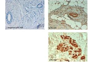 Immunohistochemistry of Rabbit anti ABCB5 antibody.