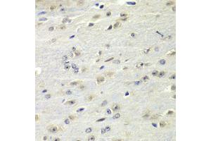Immunohistochemistry of paraffin-embedded mouse brain using FMR1 Antibody (ABIN5973291) at dilution of 1/100 (40x lens). (FMR1 anticorps)