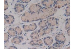 Detection of PZP in Mouse Intestine Tissue using Polyclonal Antibody to Pregnancy Zone Protein (PZP)