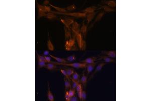 Immunohistochemistry of paraffin-embedded rat spleen using Caspase-9 Rabbit pAb (ABIN6131534, ABIN6137975, ABIN6137977 and ABIN6213766) at dilution of 1:50 (40x lens).