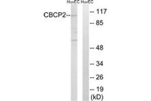 Western blot analysis of extracts from HuvEc cells, using CBCP2 Antibody. (AGBL2 anticorps  (AA 731-780))