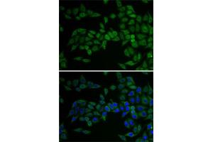 Immunofluorescence analysis of U2OS cells using E2F6 antibody (ABIN1679632, ABIN1679631, ABIN5664137 and ABIN6219769). (E2F6 anticorps  (AA 1-281))