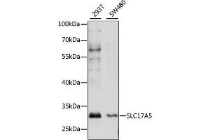 Western blot analysis of extracts of various cell lines, using SLC17 antibody (ABIN7270404) at 1:1000 dilution. (Solute Carrier Family 17 (Acidic Sugar Transporter), Member 5 (SLC17A5) (AA 1-100) anticorps)