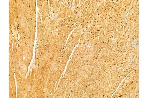 ABIN6265988 and ABIN6273055 at 1/100 staining Mouse heart tissue by IHC-P.