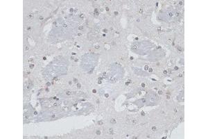 Immunohistochemistry of paraffin-embedded Mouse brain using USP7 Polyclonal Antibody at dilution of 1:100 (40x lens). (USP7 anticorps)