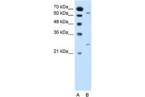 WB Suggested Anti-NAT2 Antibody Titration:  2. (NAT2 anticorps  (Middle Region))
