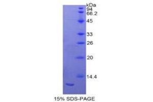 SDS-PAGE analysis of Rat S100A11 Protein.