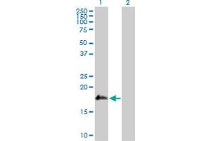 Western Blot analysis of SSH2 expression in transfected 293T cell line by SSH2 MaxPab polyclonal antibody. (SSH2 anticorps  (AA 1-178))
