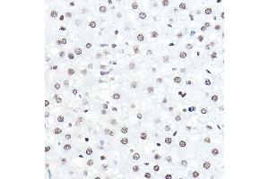 Immunohistochemistry of paraffin-embedded rat liver using ELF5 Rabbit pAb (ABIN6130882, ABIN6140130, ABIN6140131 and ABIN6222999) at dilution of 1:50 (40x lens). (ELF5 anticorps  (AA 1-170))