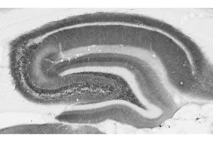 Adult rat hippocampal immunohistochemistry.